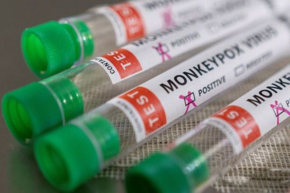 MOHAP: 5 new cases of Monkeypox detected