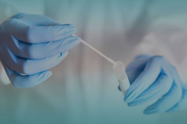 New COVID-19 PCR procedures for close contacts