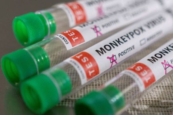 MOHAP: 5 new cases of Monkeypox detected