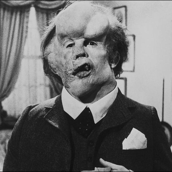 Script To Screen: “The Elephant Man”