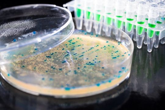 💊 AI has found a new type of antibiotic that works against many resistant bacteria