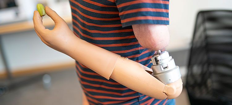 💪 Arm prosthesis that gives a sense of feeling back