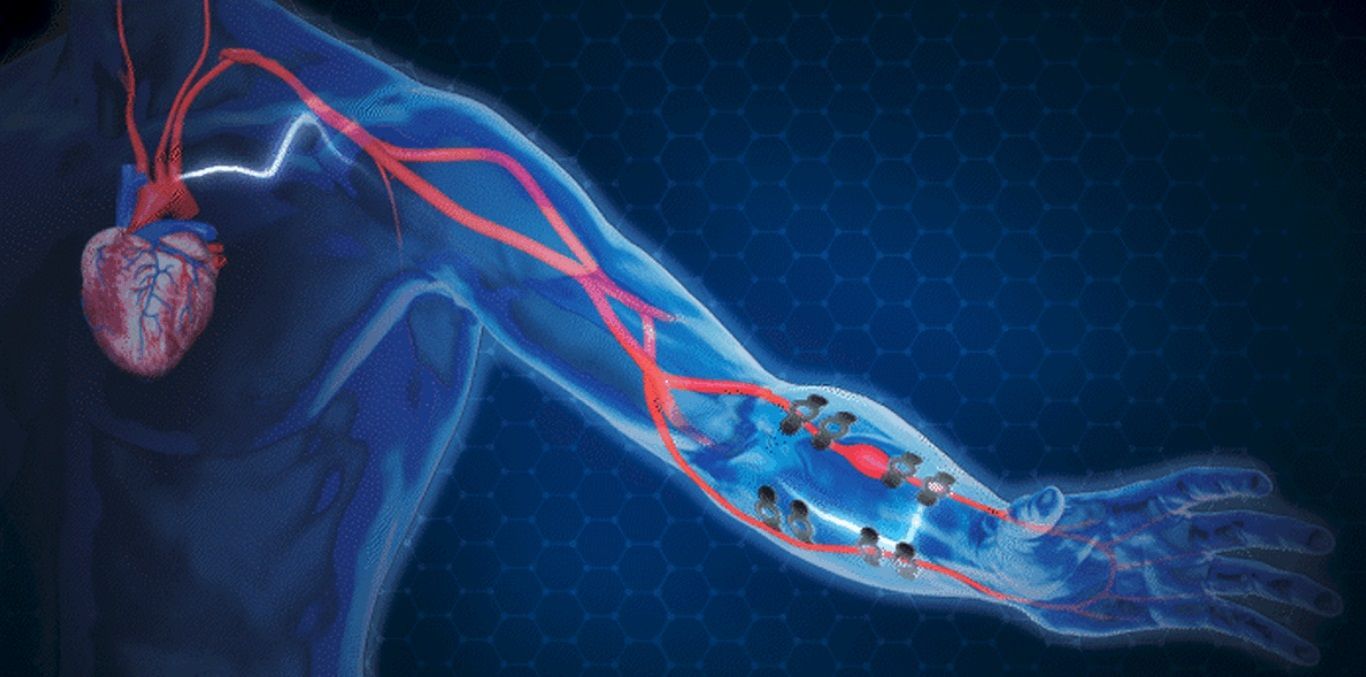 🩺 E-tattoo keeps track of your blood pressure