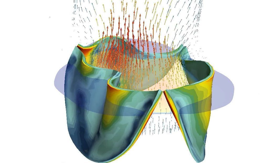 💖 Visualization will provide better and safer heart operations