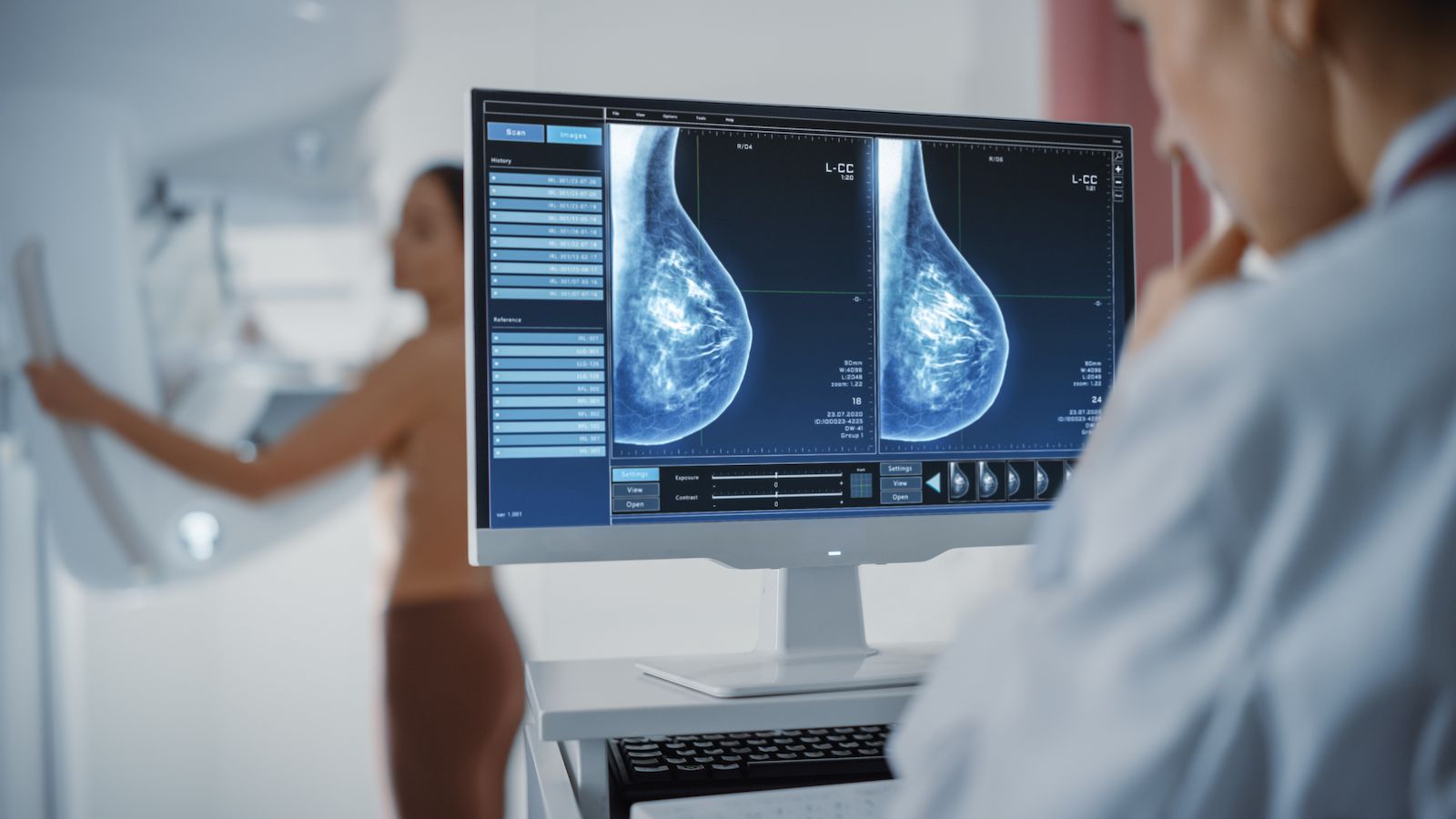 🎗️ Breast cancer detected by AI + doctors - new type of mammogram review