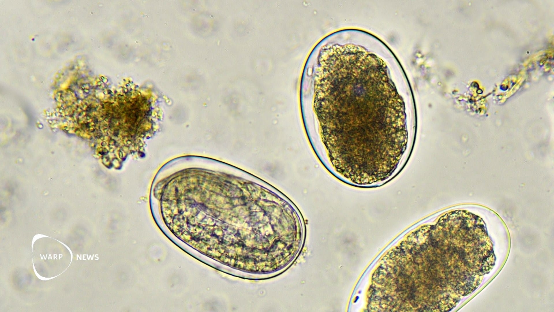 🪱 Hookworm vaccine reduces infection in trial – could help millions with anemia