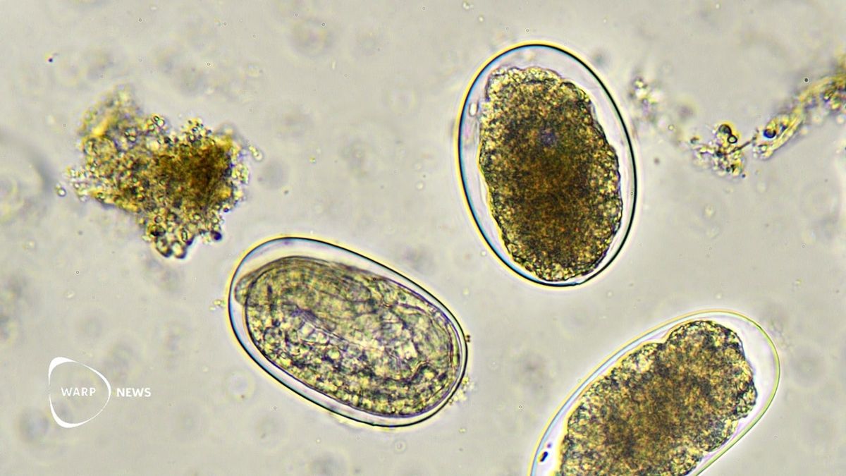 Hookworm Vaccine Reduces Infection and Combats Anemia in Trial - News Directory 3