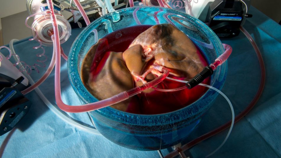 New ‘super-cool’ storing method triples the life of donor organs