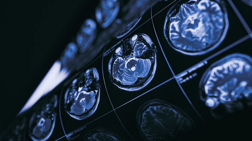 AI Can Diagnose Like Doctors. But for Continued Progress, Research Standards Must Improve