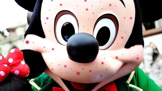 Mickey Mouse with measles