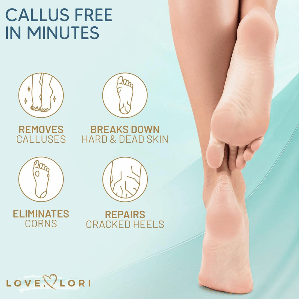Love, Lori Callus Remover