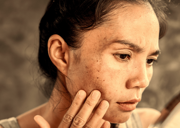 Discoloration Correcting Serum