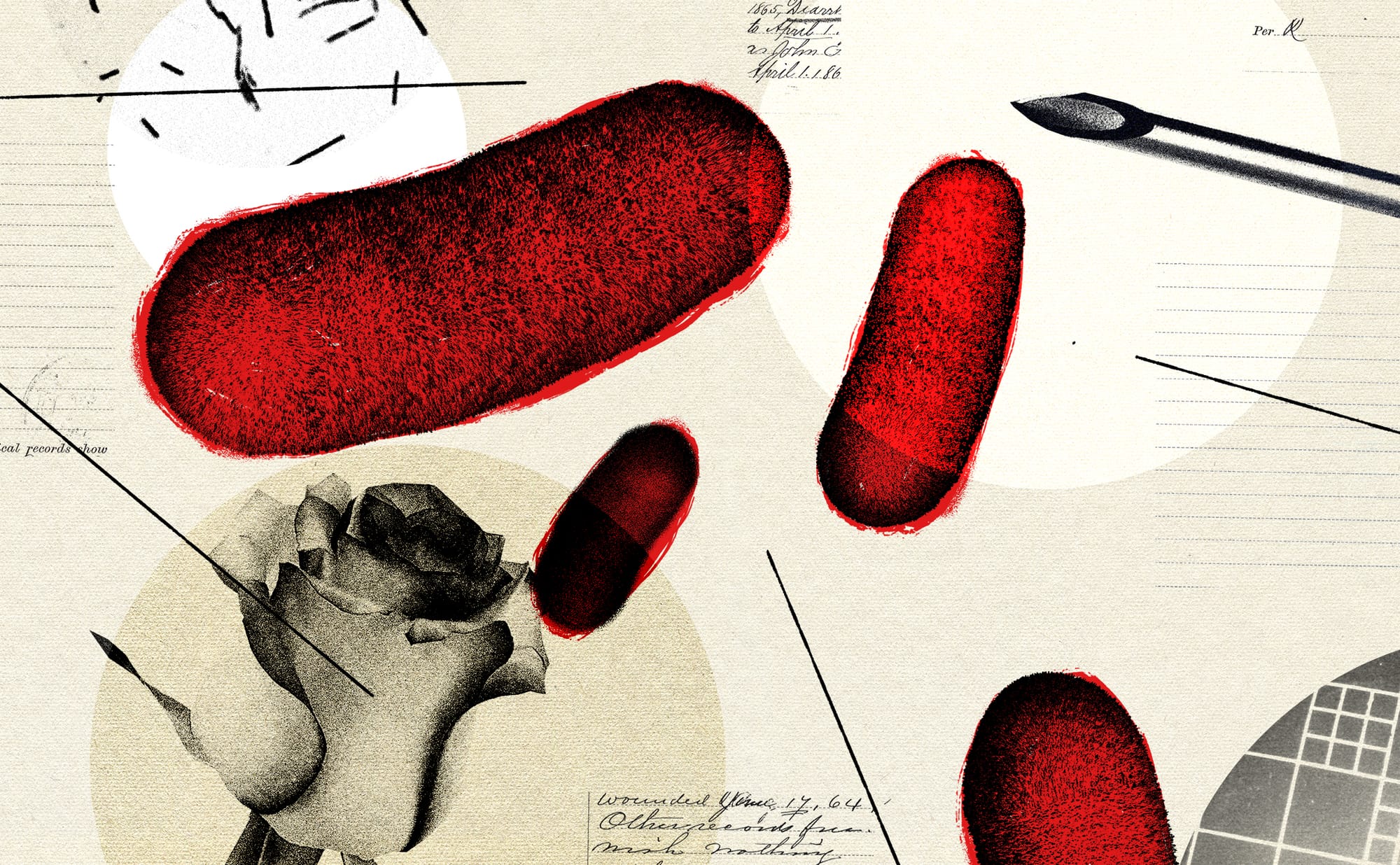 How 'the black disease' ravaged Glasgow