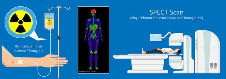 Nuclear Medicine Images | Nuclear Medicine | UPSC