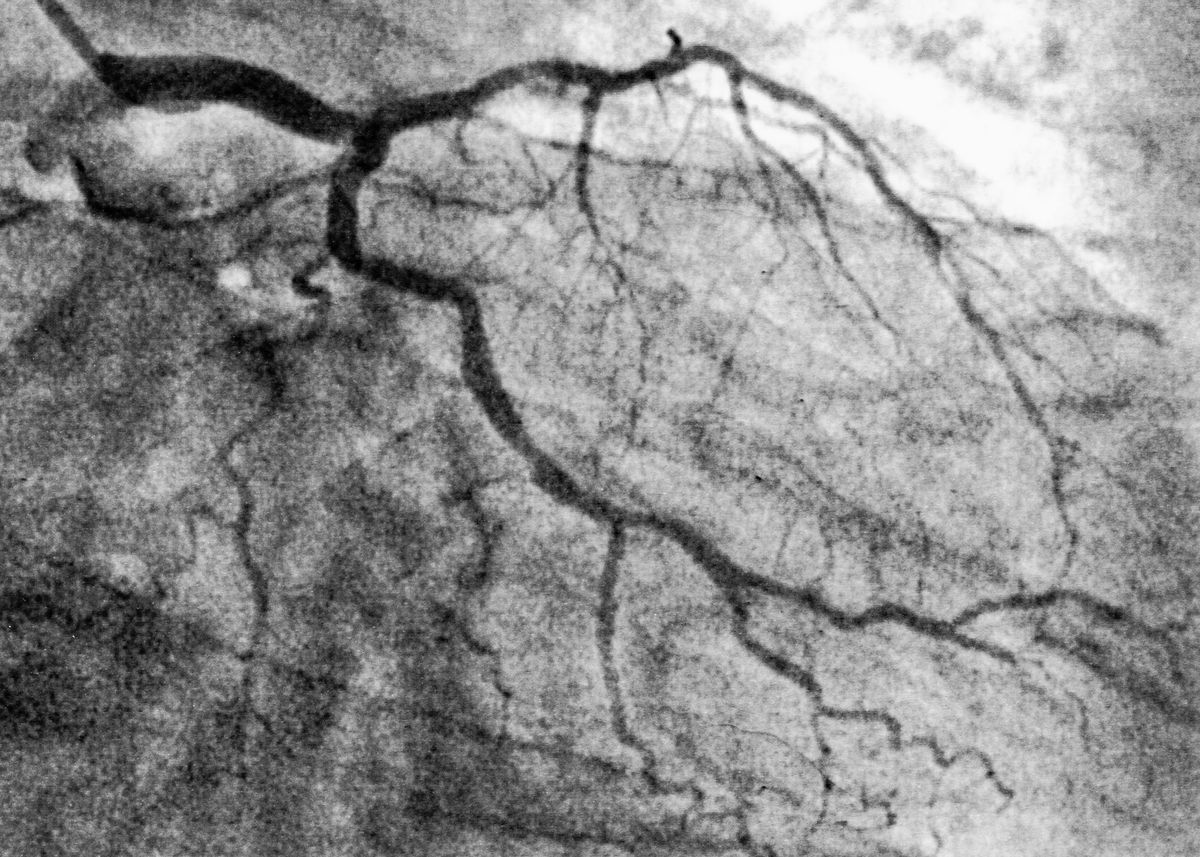 Heart Problems Resolved (3 x Cabbage), 12-17-2018