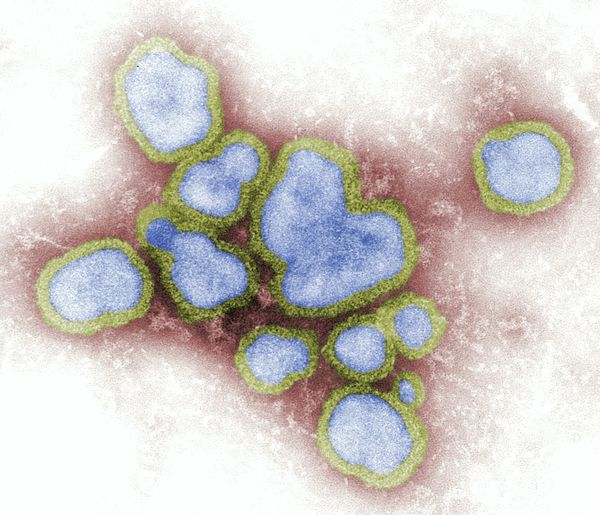 Aaaa-choo: authorities warn it could be a long flu season ahead