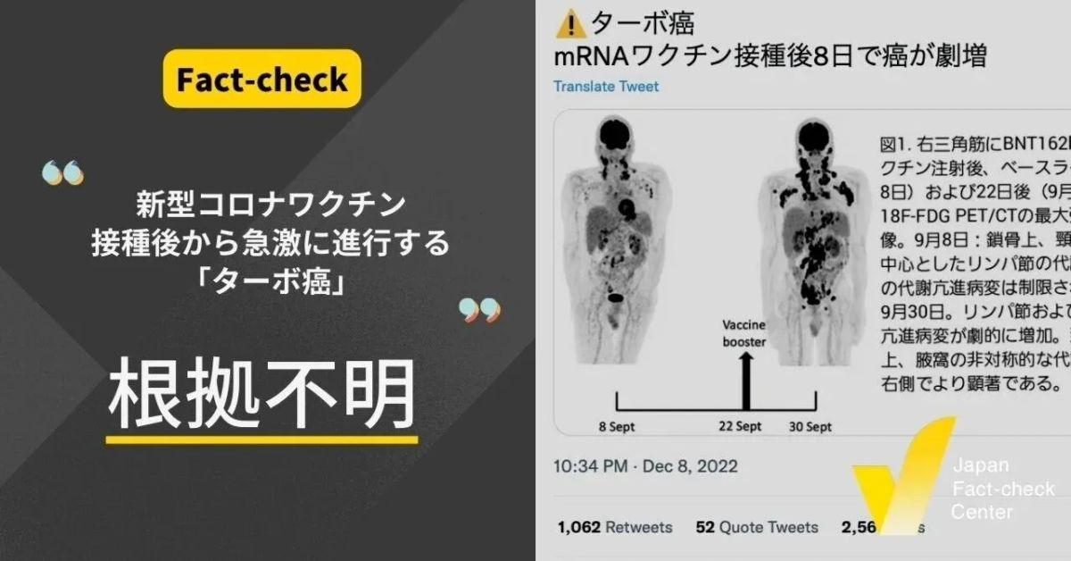 コロナワクチン接種後から急激に進行する「ターボ癌」？【ファクトチェック】