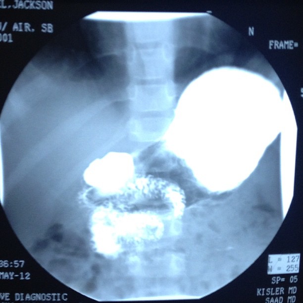 Jackson’s insides.  (Taken with instagram)