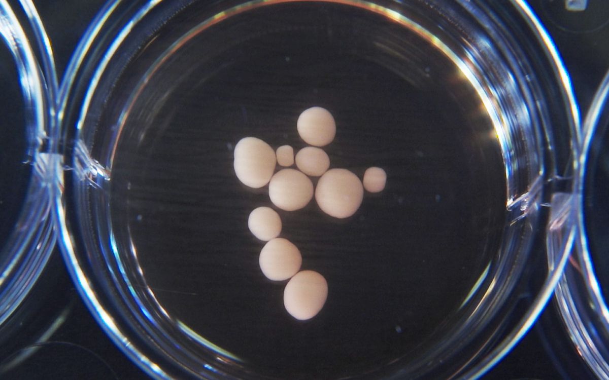 Fairy Controversial: Organoid Intelligence