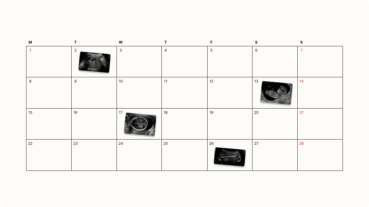 A calendar with pregnancy scan images on top to illustrate when to get each scan