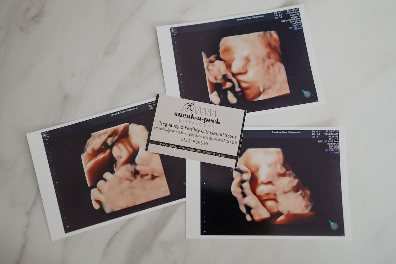 Premium prints of a 4D Baby Scan in Barnstaple available to purchase at Sneak-A-Peek Ultrasound.