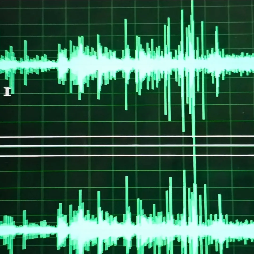 AUDIO ALERT: Dog Poop, a French Drain and Criminal Trespassing