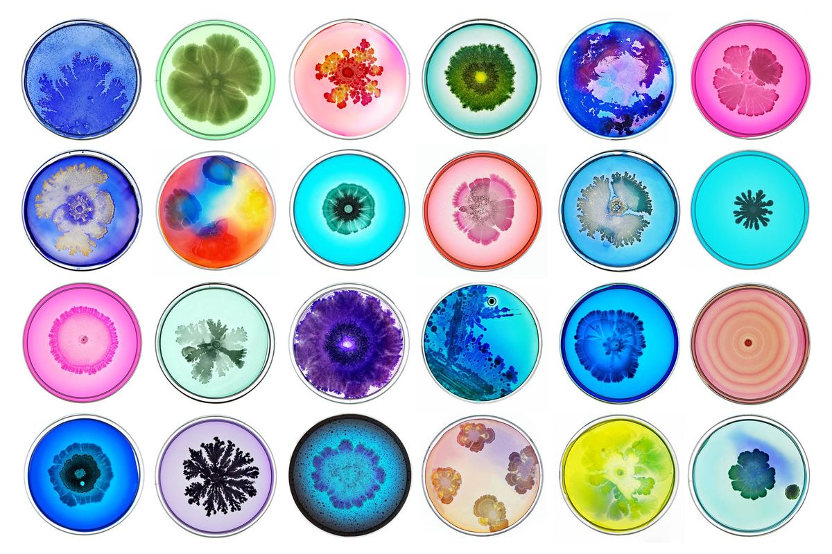 Serratia Marcescens: The Opportunistic Pathogen Lurking in Unexpected Places