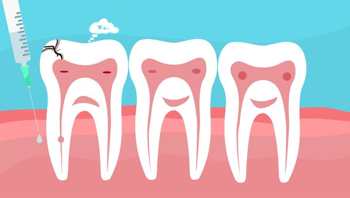 The Whole Tooth: Why Dental Numbing Isn't as Bad as You Think