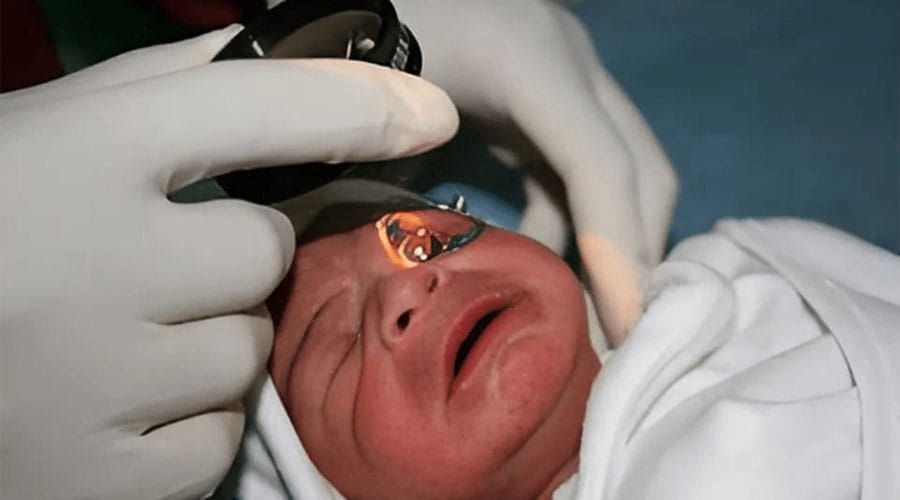 AI Analysis of Eye Photos Could Transform Early Detection of Lung and Heart Conditions in Premature Infants