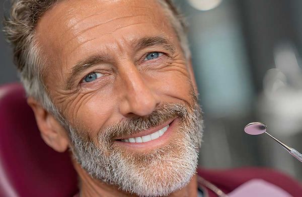 Impianti dentari, le cose da sapere