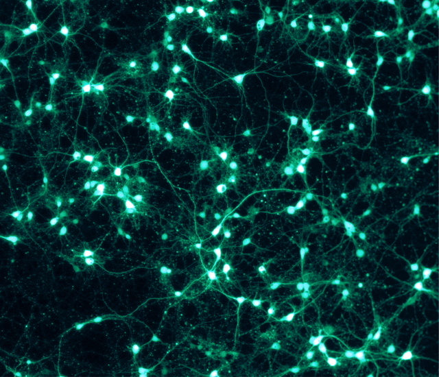 Notable Progress Has Been Made in Whole Brain Emulation