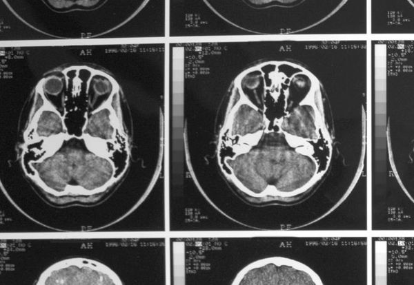 Understanding how the student brain works