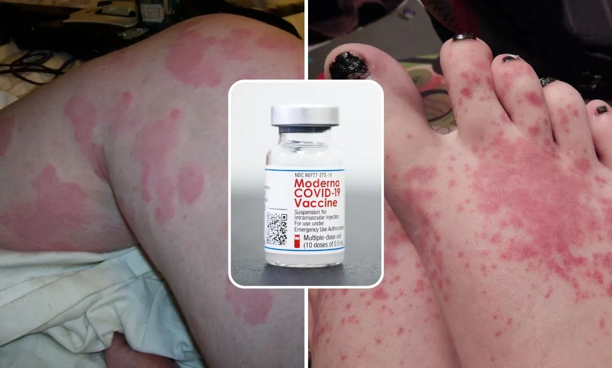 Alarming News for Moderna Vaccine Recipients