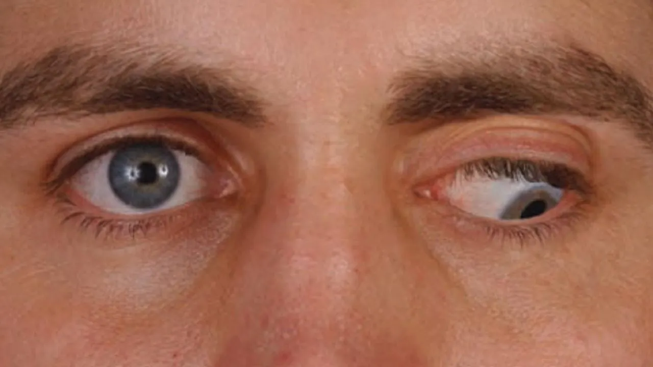 COVID Shots Break People’s Eyes — Study