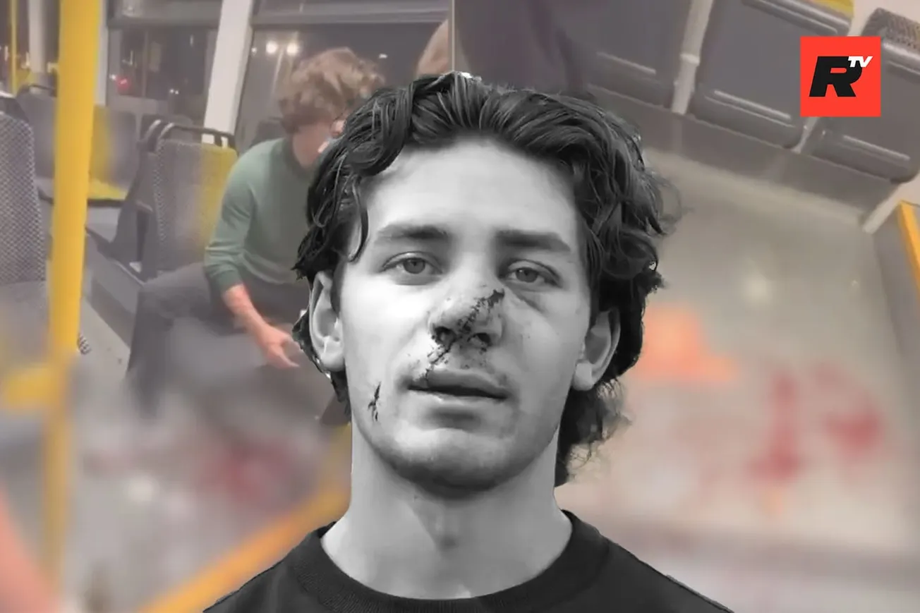 American's Face Ripped Open by Migrant – Blasts Germany's Migrant Madness, Calls for Deportations Now