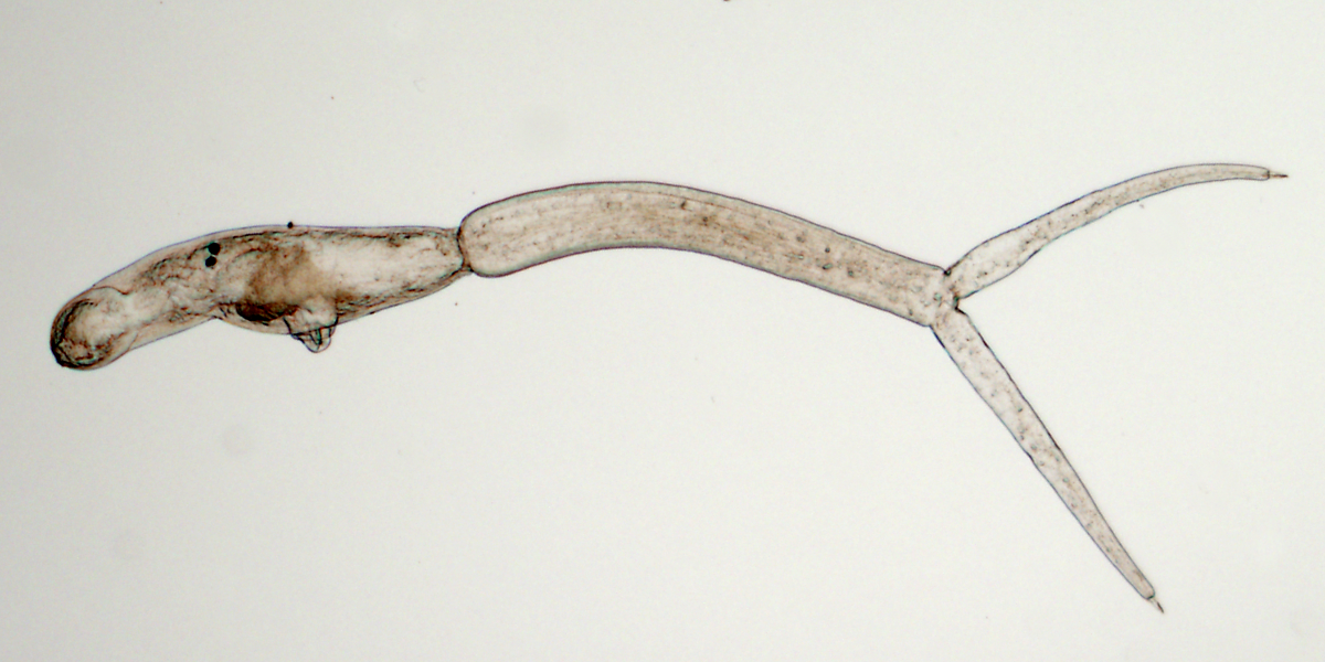 Swimmers beware: Parasitic flatworm larvae found in three Berlin lakes