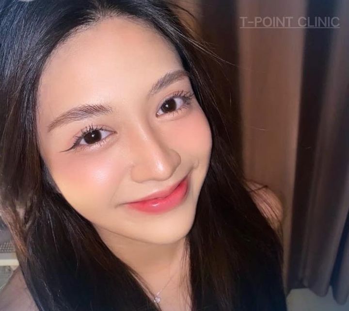 สาระน่ารู้ของการเสริมจมูก เชียงใหม่