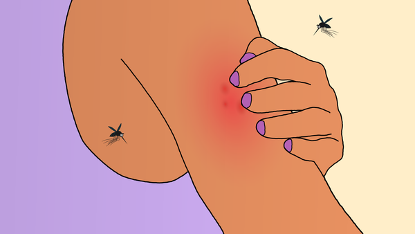 Yazın kabusu sivrisineklerle mücadele rehberi