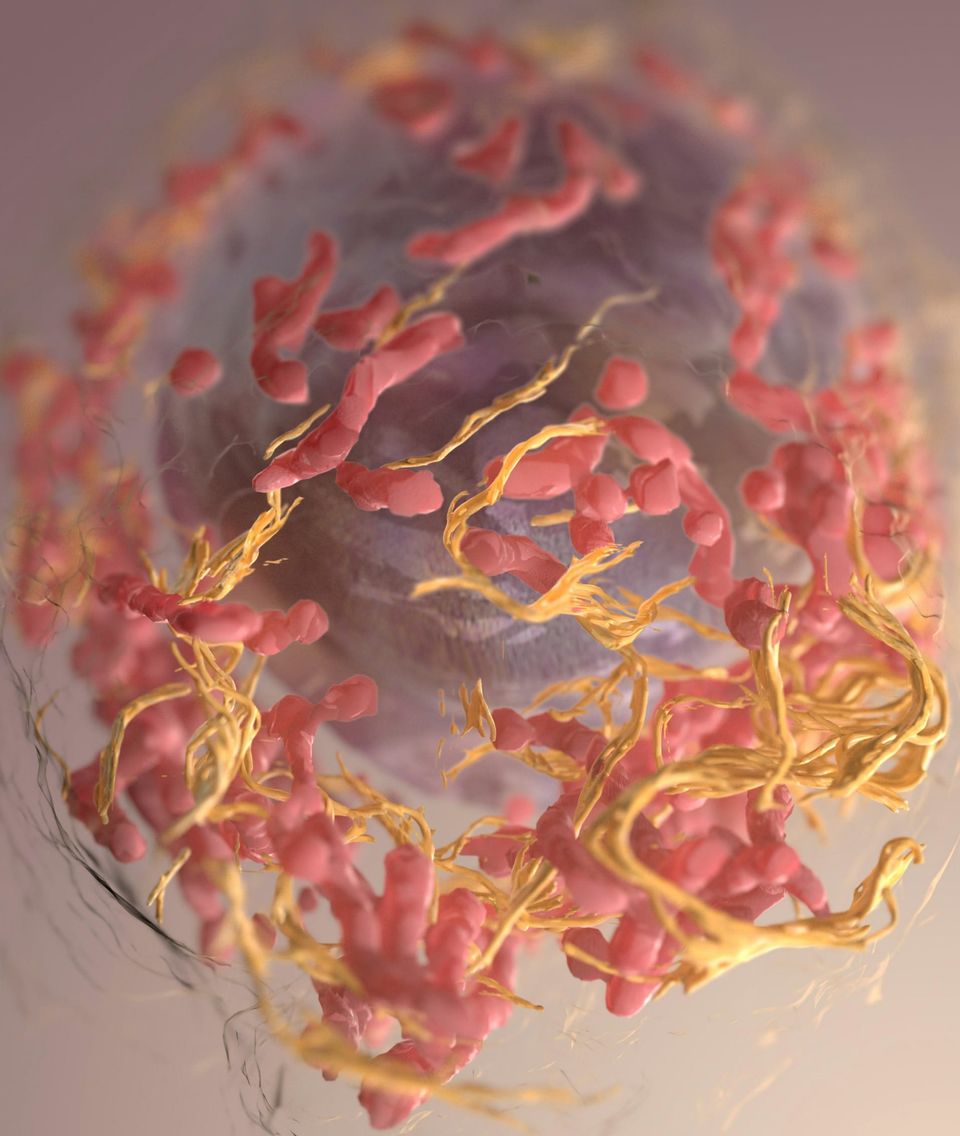 Global cancer fix: AI delivers country-by-country blueprint