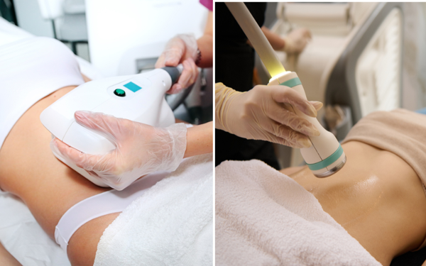 Shaping Expectations: Exploring What Are the Pros and Cons of Body Sculpting