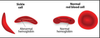 Sickle Cell Walk This Weekend