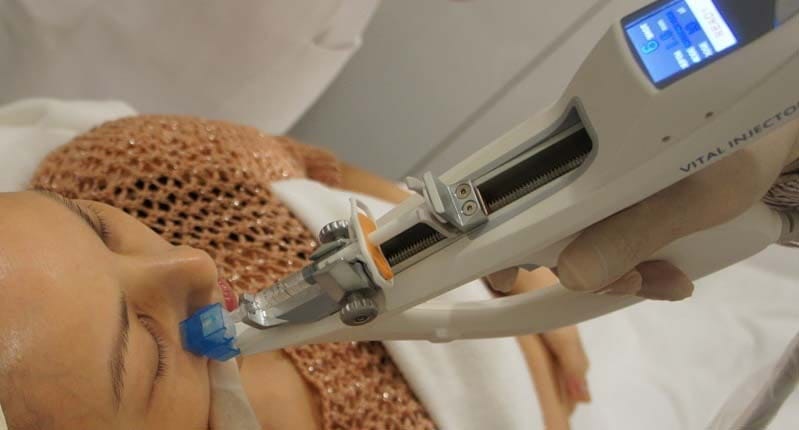 Struggling with Dry Skin? What You Should Know About Hyaluronic Acid Injections — 2