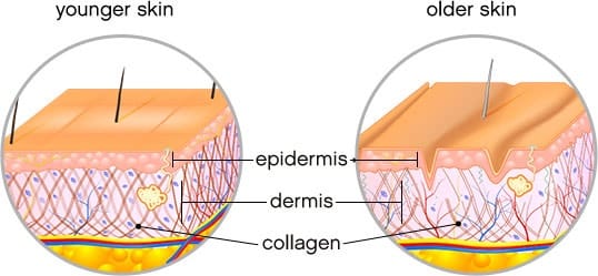 Will Wrinkles Get Worse If You Stop Getting Filler? Doctor's Column by Day One Clinic Gangnam