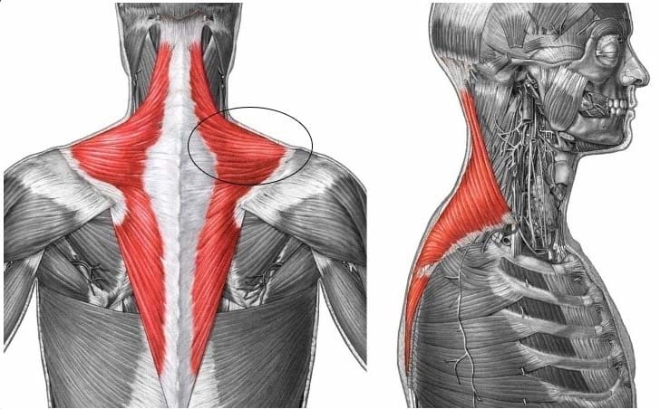 Trapezius Botox for Shoulder Pain and Slimmer Shoulder Line — 2