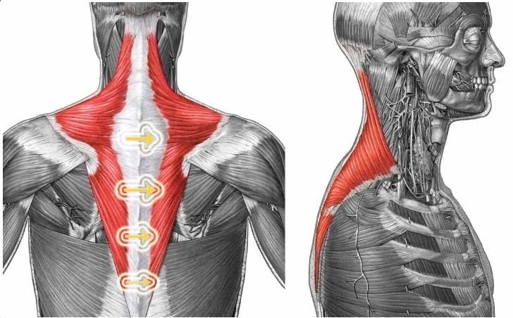 Trapezius Botox for Shoulder Pain and Slimmer Shoulder Line — 3