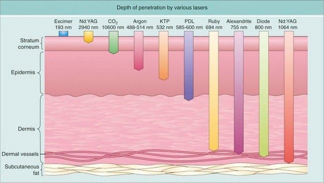Laser Fundamentals: Photothermal Effect and Thermal Relaxation Time (TRT) Explained — Day One Clinic Gangnam