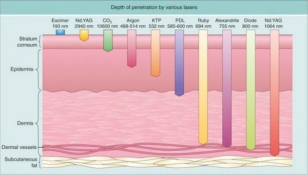 Laser Fundamentals: Photothermal Effect and Thermal Relaxation Time (TRT) Explained — Day One Clinic Gangnam