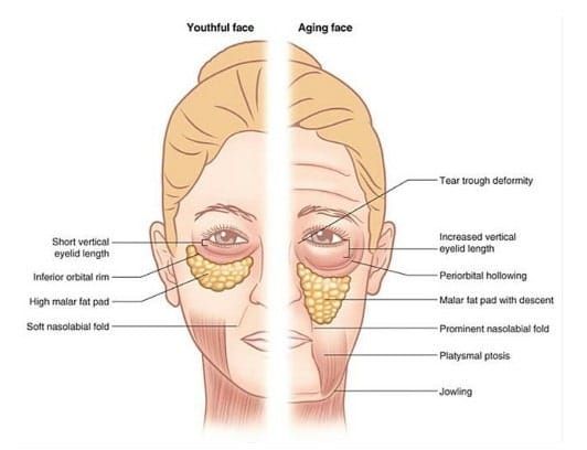 Why Skin Ages and How Lifting Treatments Work
