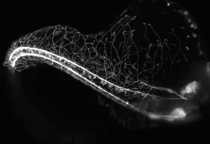 #136 – Elrontott zen állapot