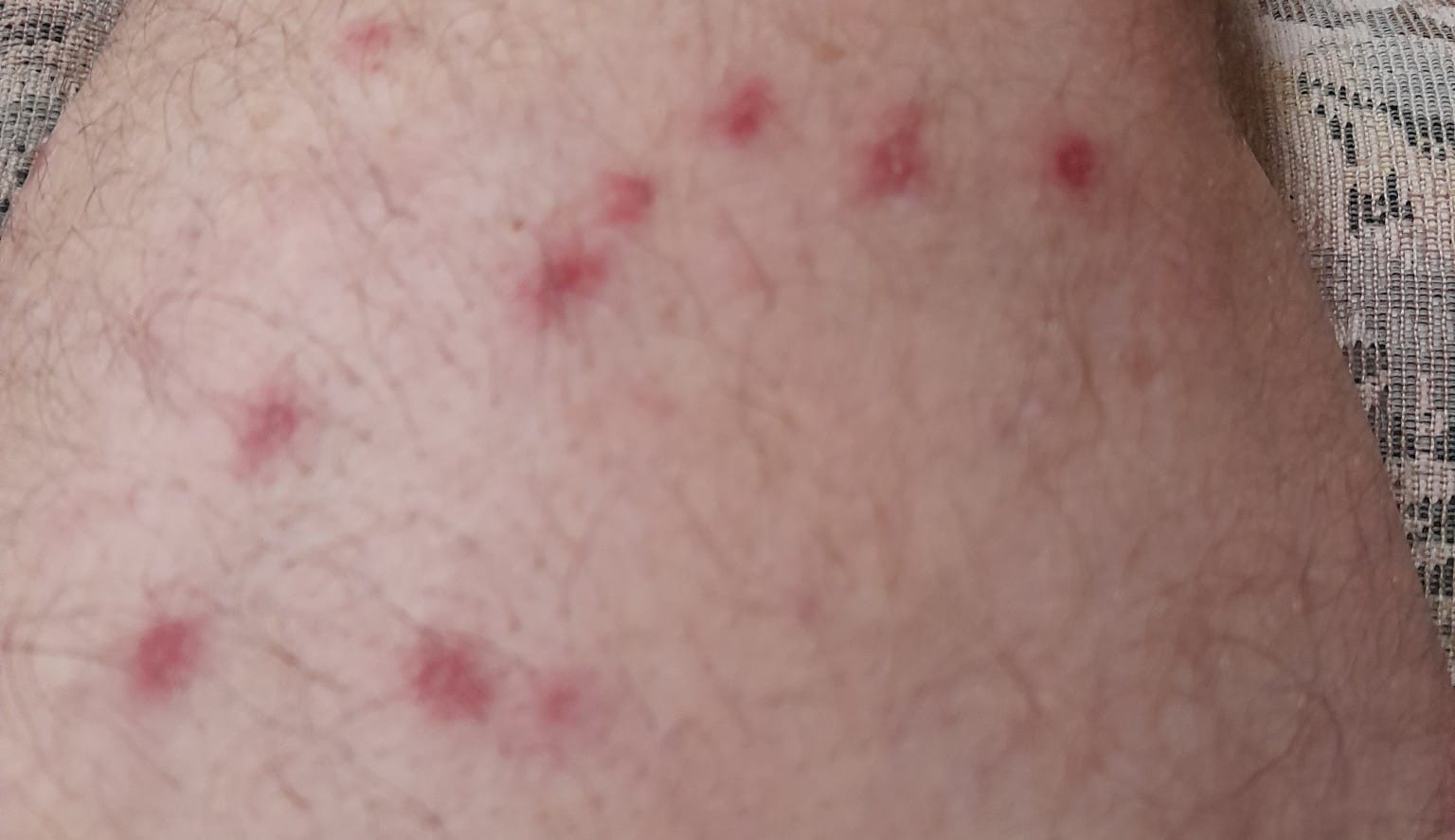 Stinging reminder to bee very careful